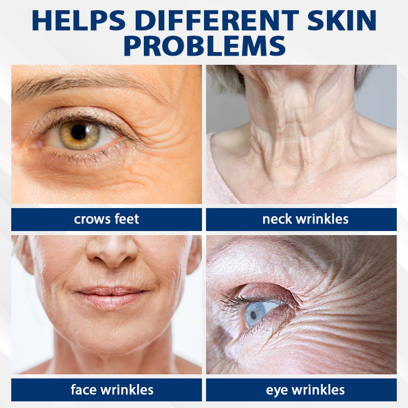 TightenLift™ ApisVenom Blue Tansy WrinkleErase Cream