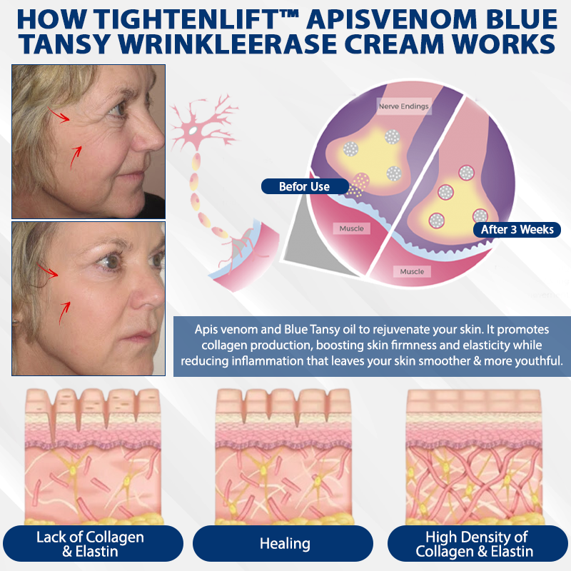 TightenLift™ ApisVenom Blue Tansy WrinkleErase Cream