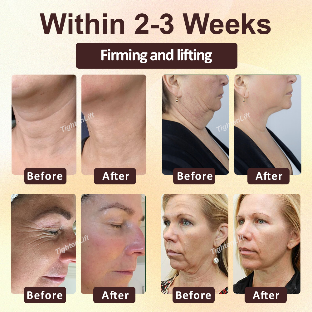 ATTDX® ApisRepair Firming Serum Stick