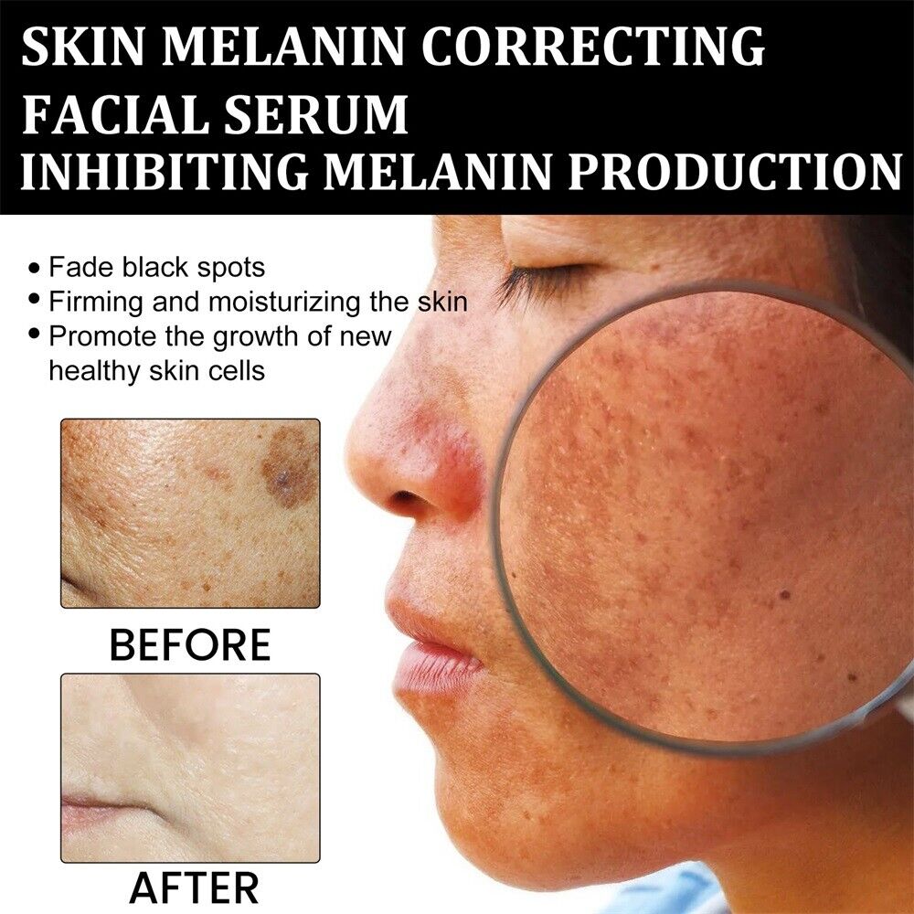 ApisDerm™ Melanin Correcting Facial Serum