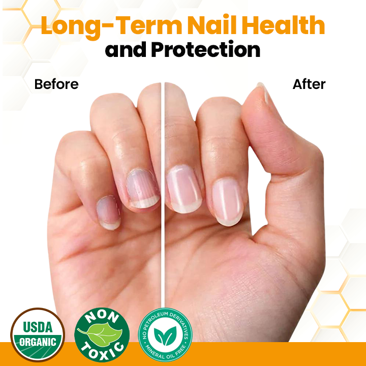 ApisHeal™ BeeVenom Anti-Fungal Nail Renewal Oil