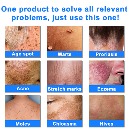 ATTDX® C+ Skin Dermatitis Cream