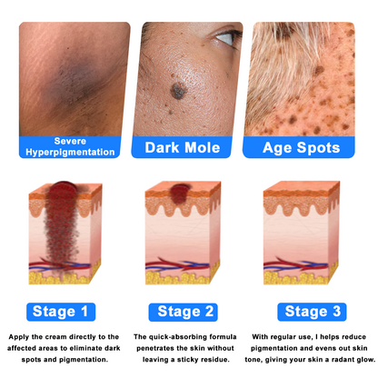 ATTDX® C+ Skin Dermatitis Cream