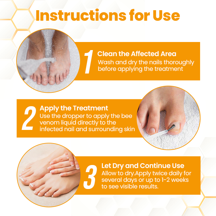 ApisHeal™ BeeVenom Anti-Fungal Nail Renewal Oil