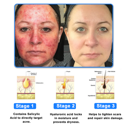 ATTDX® C+ Skin Dermatitis Cream