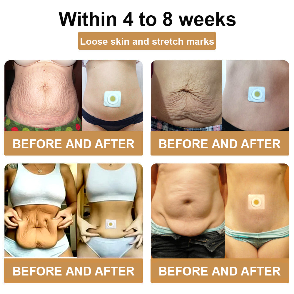 ApisThera™ Apis Venom LymphDrain Slimming Patch