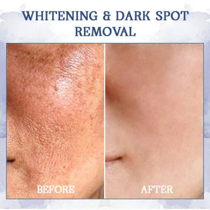 ATTDX™ Advanced Firming and Wrinkle Reducing Cream