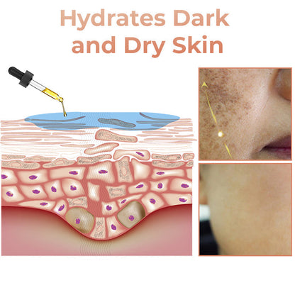 ApisDerm™ Melanin Correcting Facial Serum
