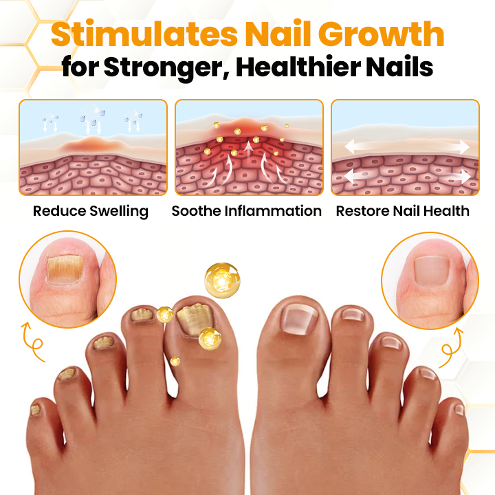 ApisHeal™ BeeVenom Anti-Fungal Nail Renewal Oil