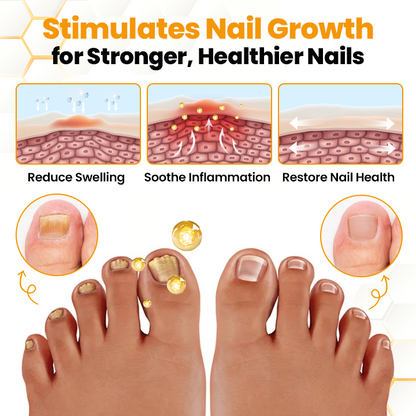 ApisHeal™ BeeVenom Anti-Fungal Nail Renewal Oil
