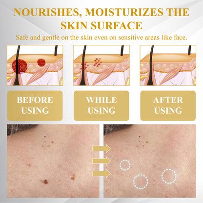 ATTDX® ApisCare Blemish & Tag Remover Stick
