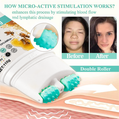 ATTDX® ApisSlim Tansy Oil Anti-Swelling Roller