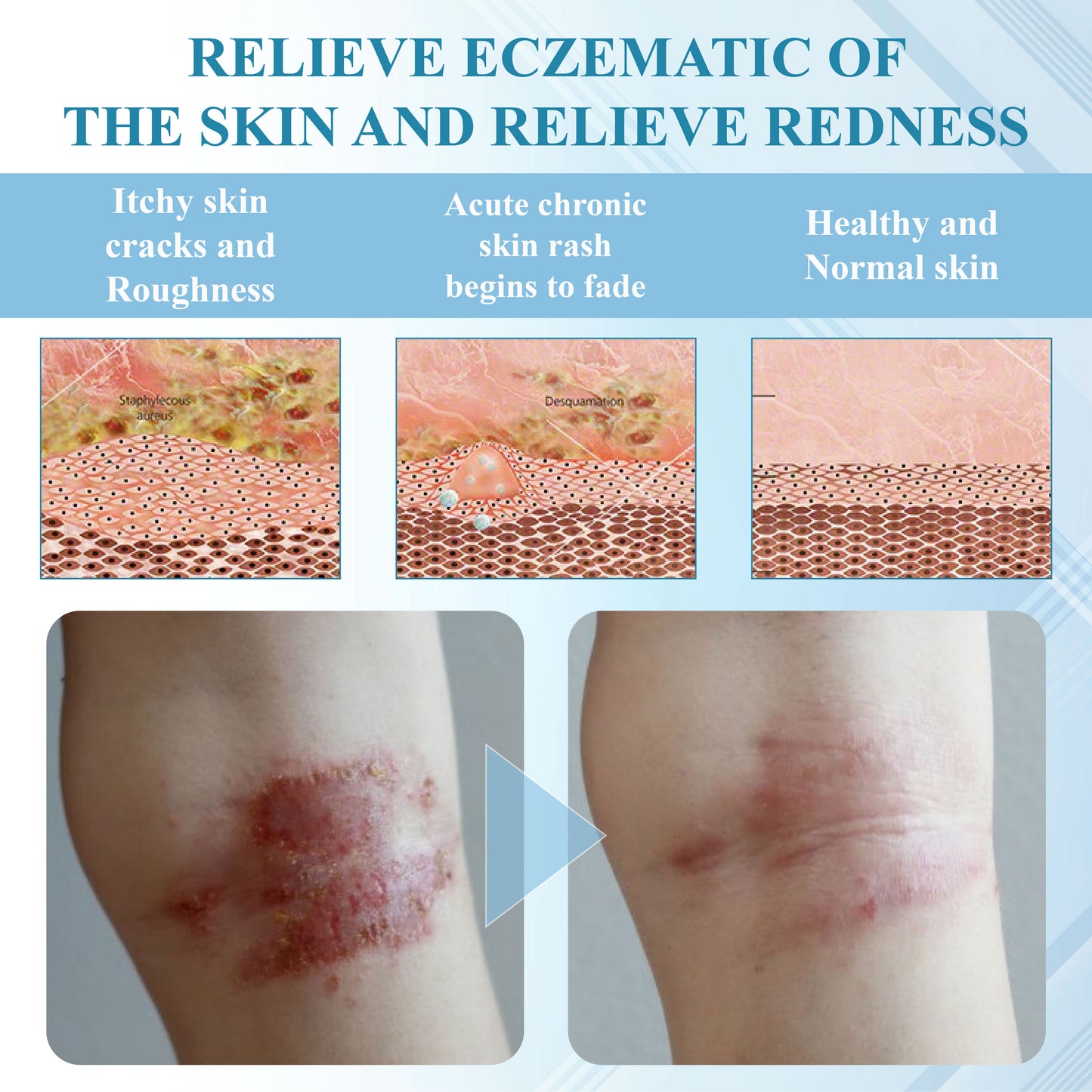 ATTDX® C+ Multi-Skin Rescue Therapy Cream