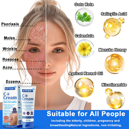 ATTDX® C+ Skin Dermatitis Cream