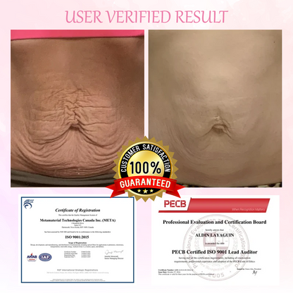 ATTDX® AdvancedSlim Pomegranate Firming Capsule Cream