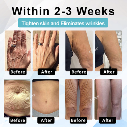 ATTDX™ SkinLift Youthful Firming Body Lotion