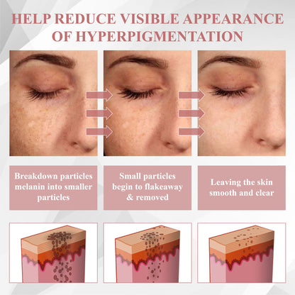 ATTDX® Tag & Blemish Peel-Off Gel Wrapping Mask