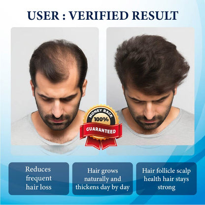 FolliFusion™ ThickBoost Herbal HairGrowth Serum for Men