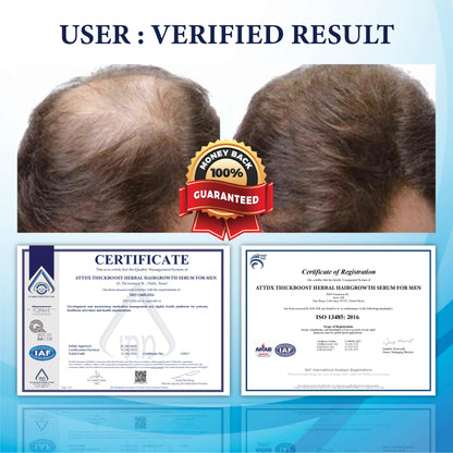 FolliFusion™ ThickBoost Herbal HairGrowth Serum for Men