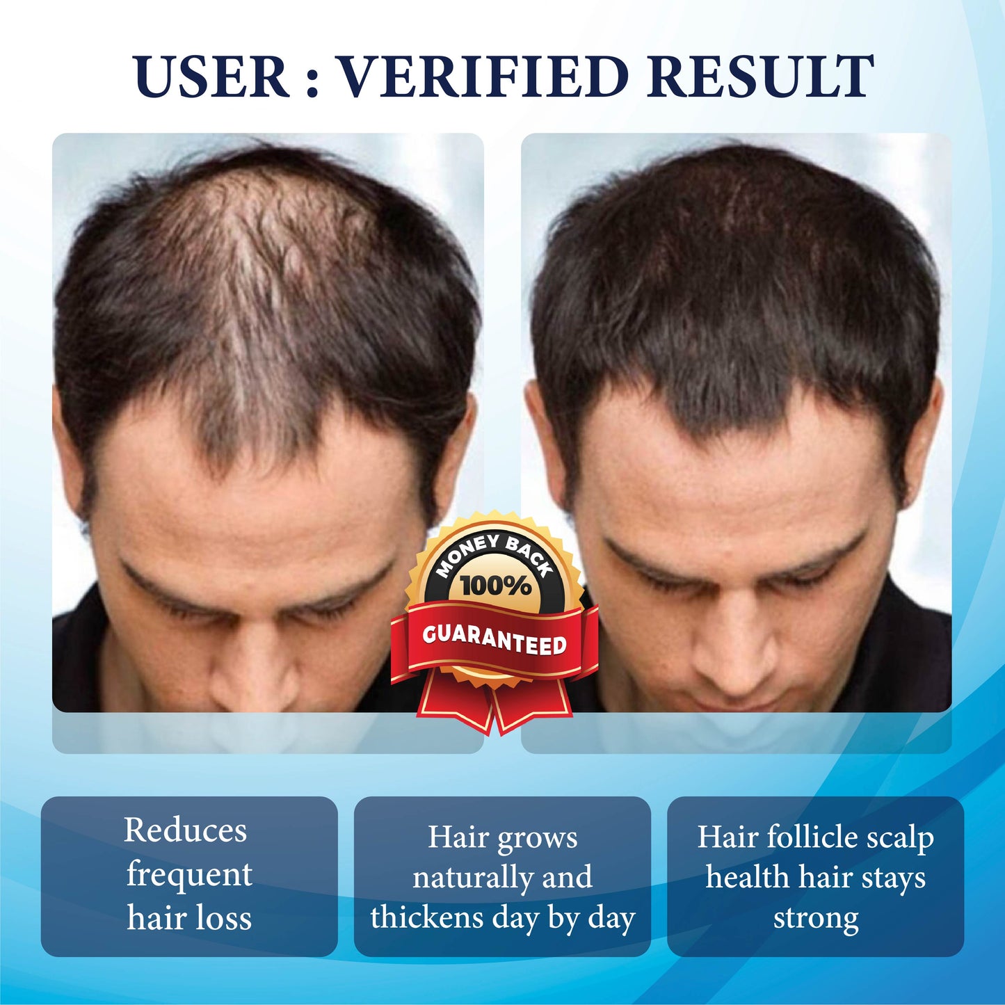 FolliFusion™ ThickBoost Herbal HairGrowth Serum for Men