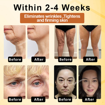 ATTDX® BeeRosehip Skin Multi-Renewal Cream
