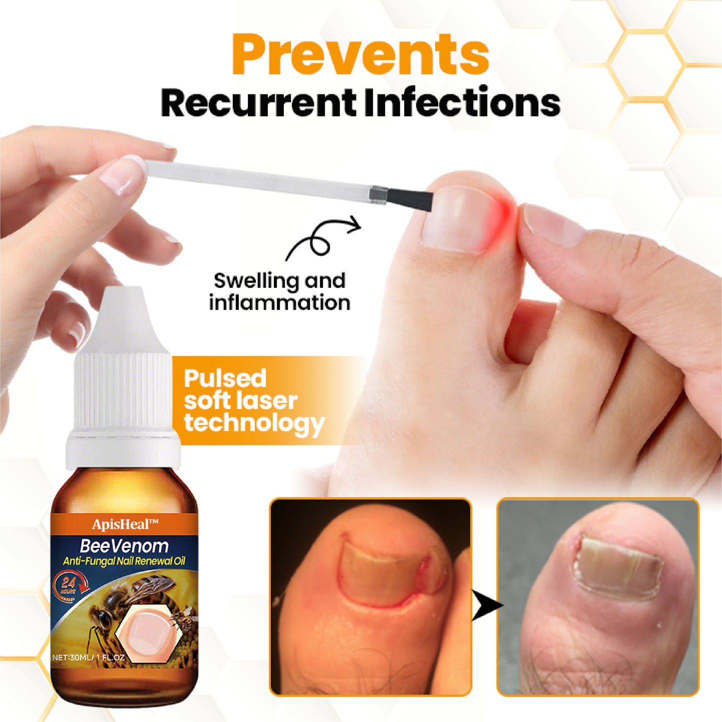 ApisHeal™ BeeVenom Anti-Fungal Nail Renewal Oil