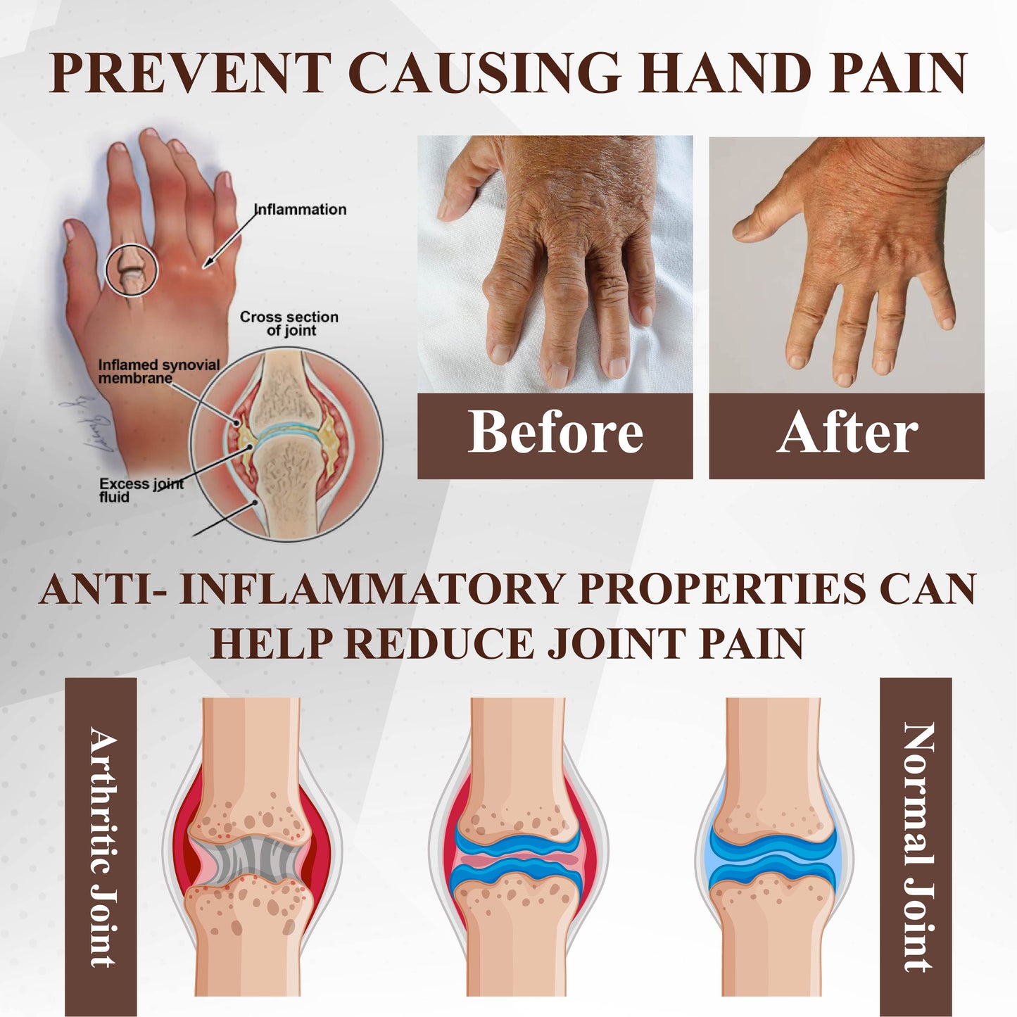 ATTDX® EmuBee Soothing Joint Therapy Gel