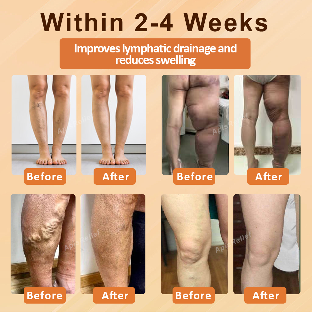 ATTDX® EdemaSlim Care DetoxBody Cream