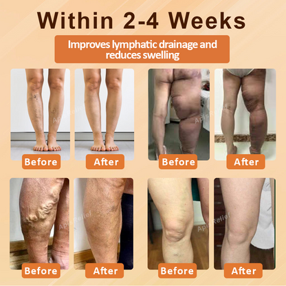 ATTDX® EdemaSlim Care DetoxBody Cream