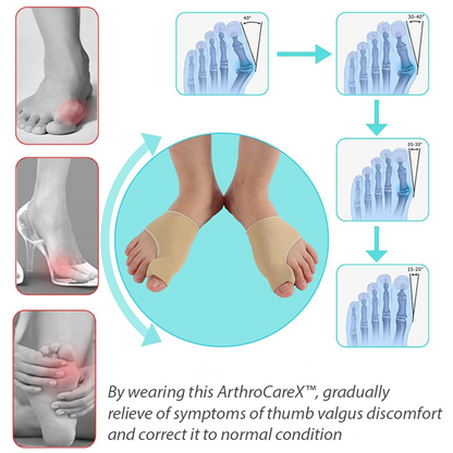 ArthroCareX™ BunionEase Corrector Sock