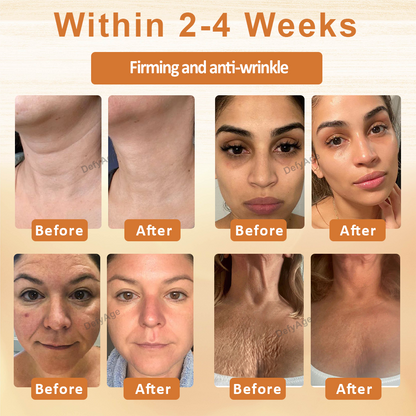 ATTDX® ApiSculpt BotoxAging Cream