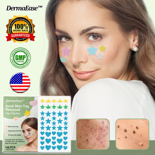 [Official Store] DermaEase™ Acne Skin Tag Removal Star Patches