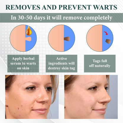 ATTDX® Skin Clear Herbal Jelly Gel