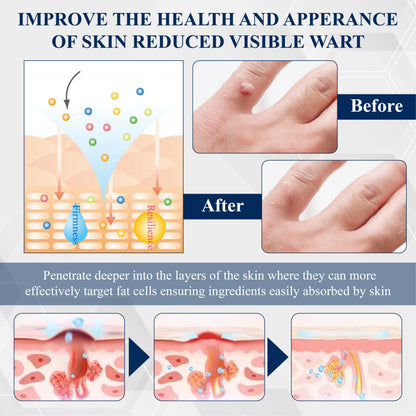 ATTDX® WartsOff Fast-Acting Herbal Cream