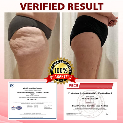 ATTDX® SwellingCare Firming and Sculpting Gel