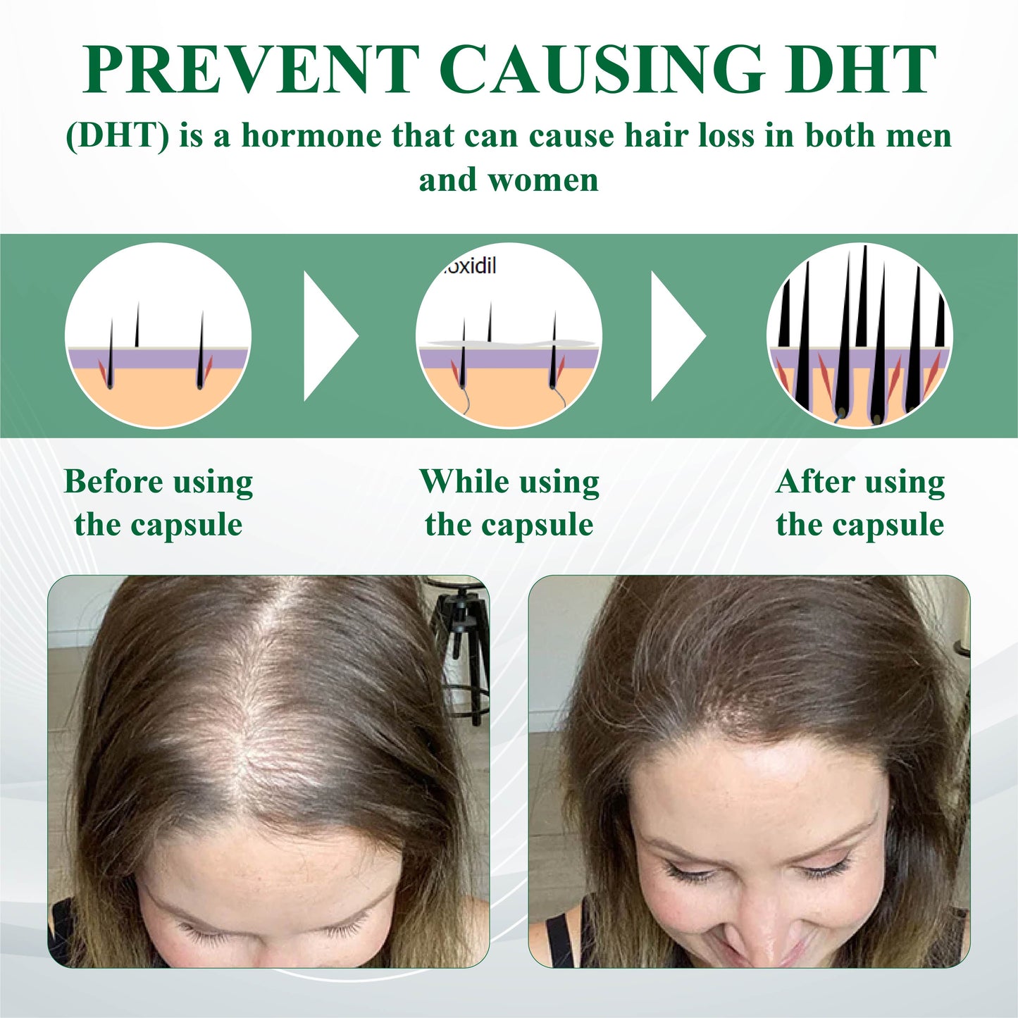 FolliFusion™ Advanced Hair Regrowth Capsules