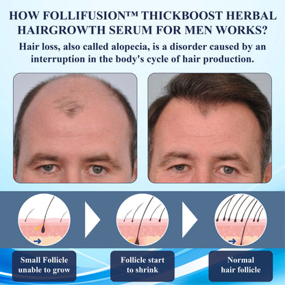 FolliFusion™ ThickBoost Herbal HairGrowth Serum for Men