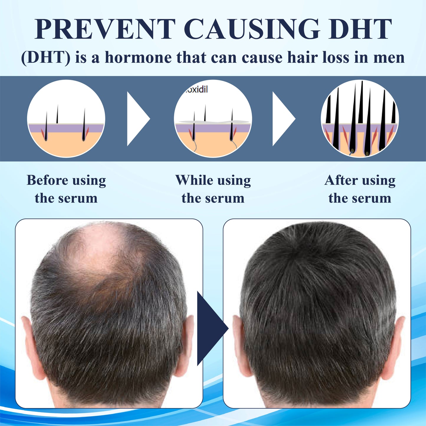 FolliFusion™ ThickBoost Herbal HairGrowth Serum for Men