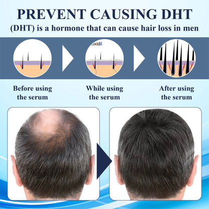 FolliFusion™ ThickBoost Herbal HairGrowth Serum for Men