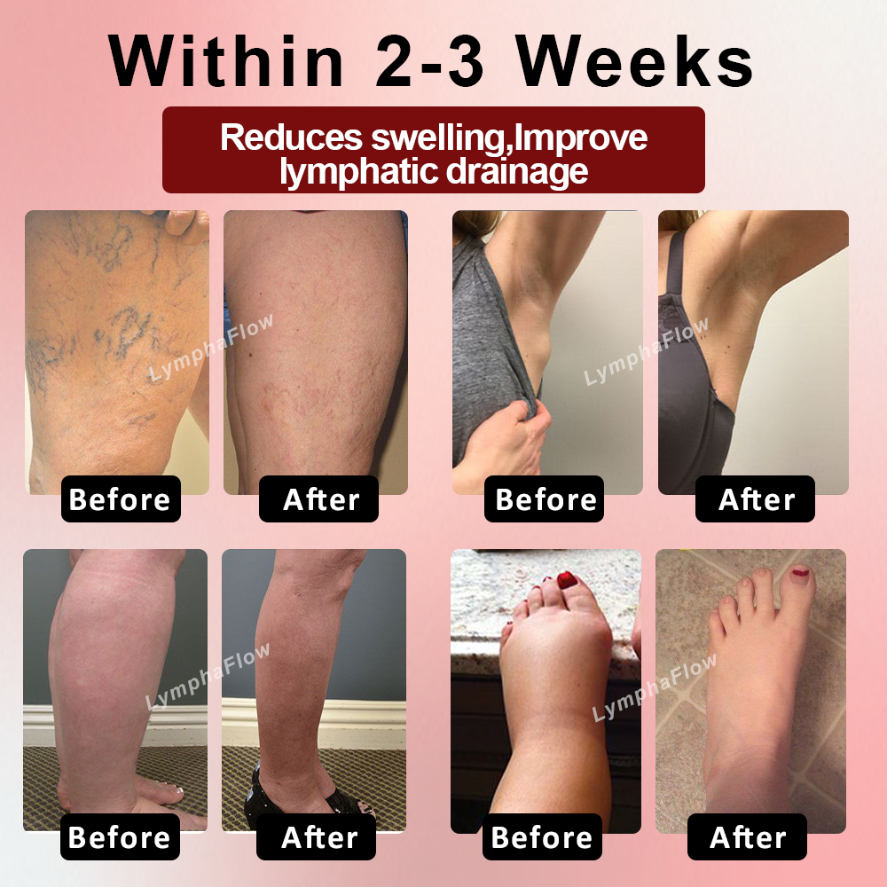 LymphaFlow™ Horse Chestnut SwellAway Massage Gel