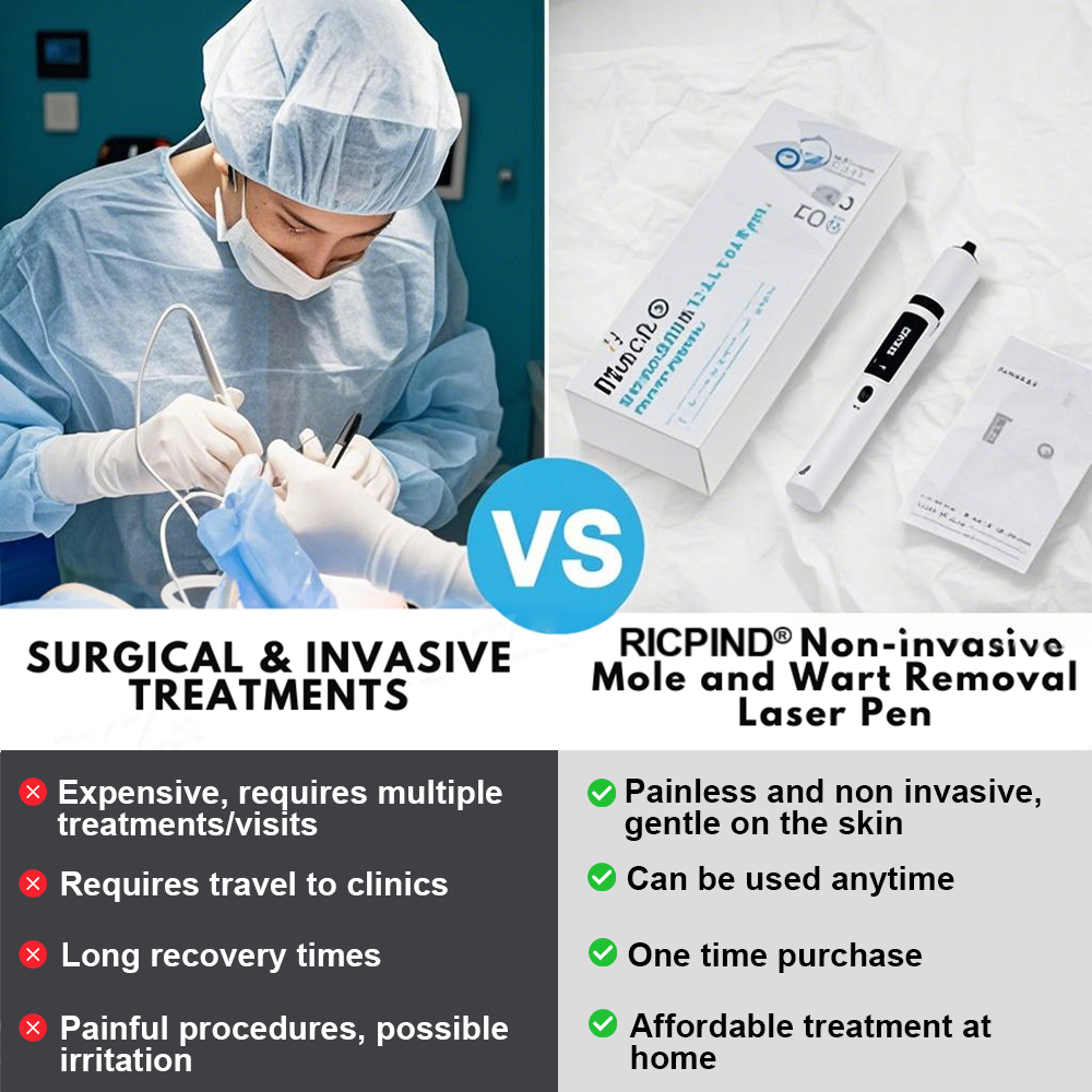 RICPIND® Non-Invasive Mole and Wart Removal Laser Pen