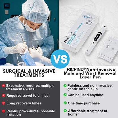 RICPIND® Non-Invasive Mole and Wart Removal Laser Pen