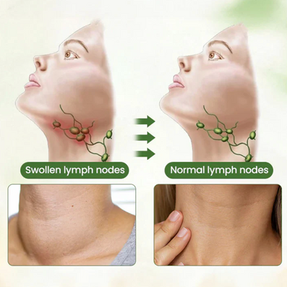 ATTDX® Lymphatic Detox Herbal Cream