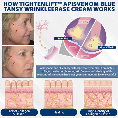 TightenLift™ ApisVenom Blue Tansy WrinkleErase Cream