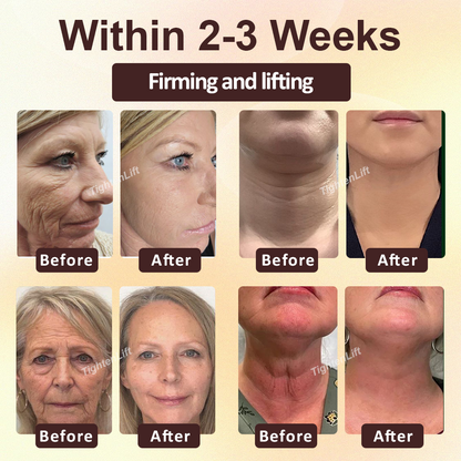 ATTDX® ApisRepair Firming Serum Stick