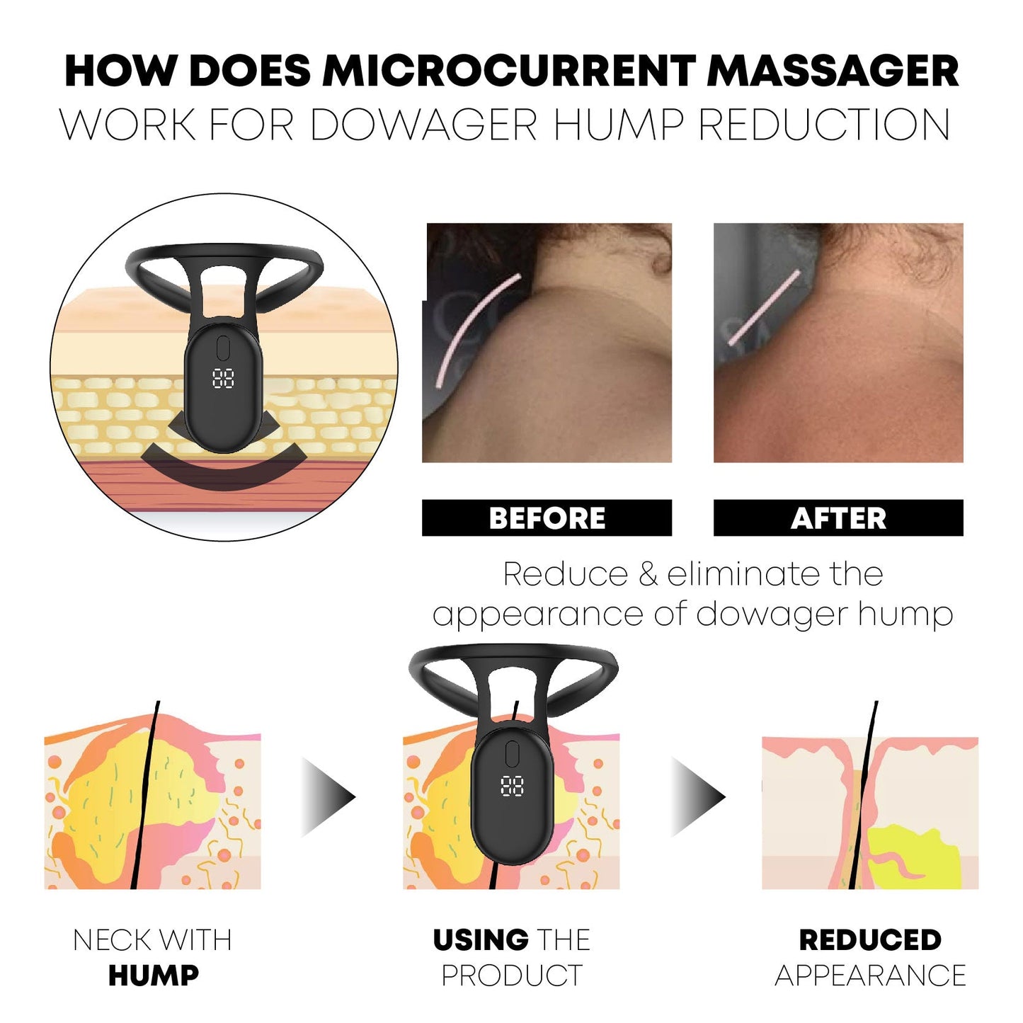RICPIND® Neckology PulseTech LymphCare Device