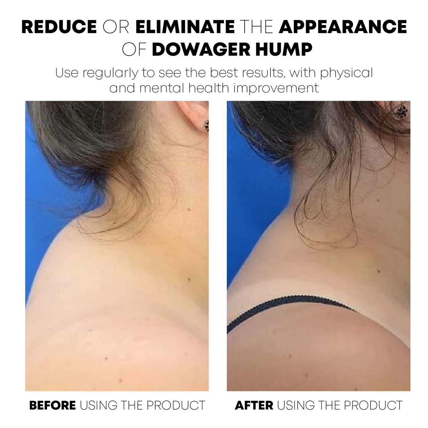 RICPIND® Neckology PulseTech LymphCare Device